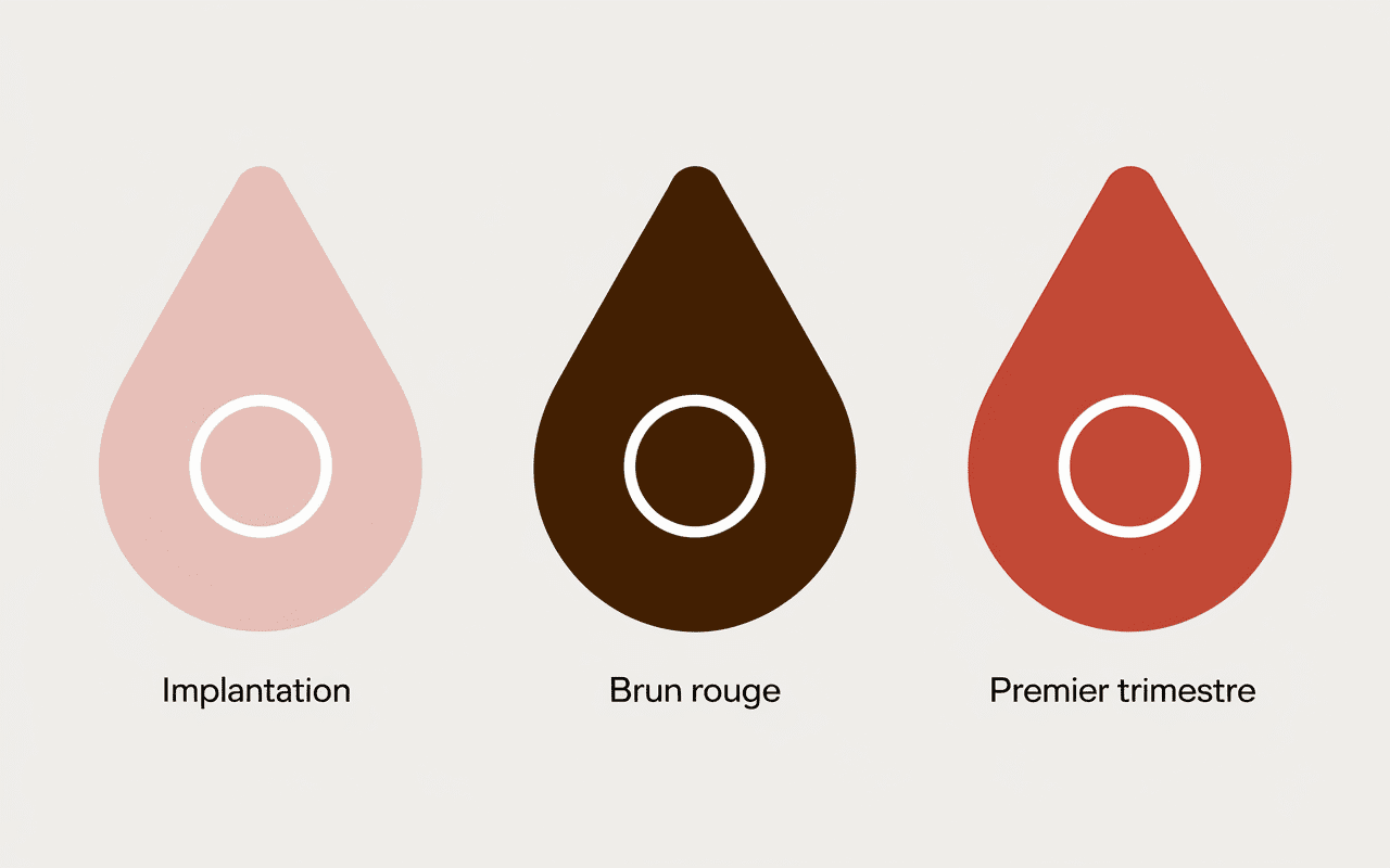 Types de saignements pendant la grossesse